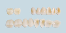 Synthetic Polymer Teeth – Acrylic Shell